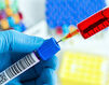 Australský antigen aneb Příběh hepatitidy B