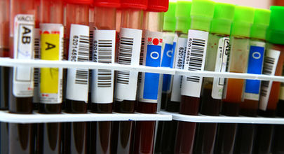 Jaká jsou rizika dárcovství krve?