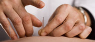 Akupunktura: může být viníkem žloutenky?