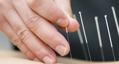 Akupunktura a riziko infekční nákazy