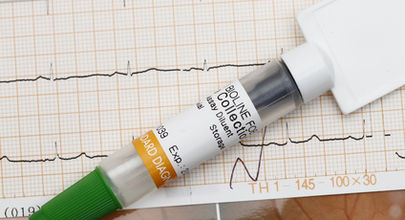 Virémie aneb Po stopách hepatitidy