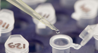 Účinnost PegIntronu v kombinaci s ribavirinem u pacientů s chronickou hepatitidou C