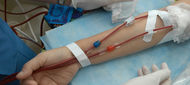 Terapie chronické hepatitidy C u hemodialyzovaných pacientů