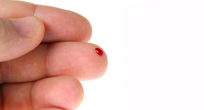 Nový test ukáže, jak bude léčba žloutenky typu C úspěšná