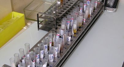  Srovnání účinku pegylovaného interferonu α-2a a α-2b v kombinaci s ribavirinem u pacientů s hepatitidou C