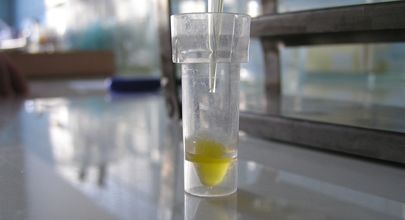 Karcinom jater a nonhodgkinský lymfom u pacientů s hepatitidou C – výsledky dánské kohortové studie