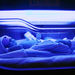 Novorozeneckou žloutenku zažene modré světlo  