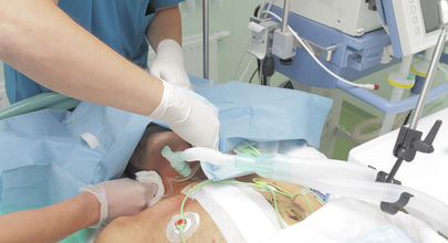 Léčba rekurentní hepatitidy C po transplantaci jater