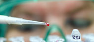 Boceprevir – novinka v léčbě chronické hepatitidy C