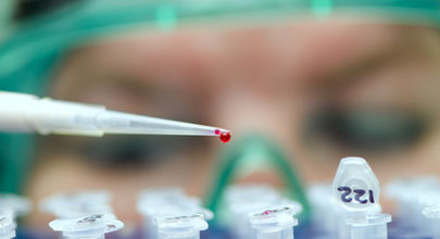 Virová hepatitida typu C: standardní diagnostický postup