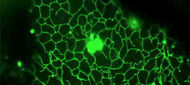 Zvýšený únik Ca2+ ze zásob endoplazmatického retikula je indukován proteinem NS5A