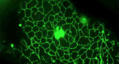 Zvýšený únik Ca2+ ze zásob endoplazmatického retikula je indukován proteinem NS5A