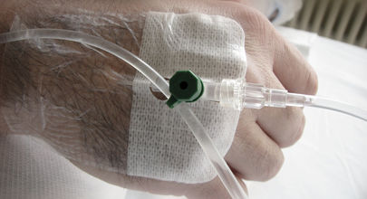 Primární, s hepatitidou C asociovaný hepatocelulární karcinom u pacientů bez cirhózy