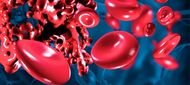 Léčba anémie u kombinované terapie chronické virové hepatitidy C: snížené dávky ribavirinu vs. erytropoetin