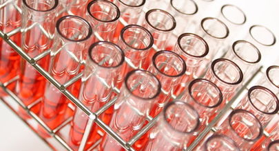 Sérové hladiny HCV RNA nejsou u pacientů s chronickou hepatitidou C spojeny s výskytem inzulinové rezistence a metabolického syndromu