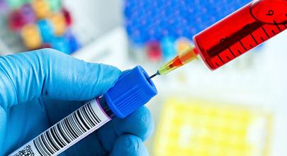 Hladina RNA viru hepatitidy C po dvou týdnech léčby telaprevirem/boceprevirem dobře predikuje výslednou virologickou odpověď