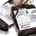 Pečlivý výběr dárce krve minimalizuje riziko nákazy nejen žloutenkou