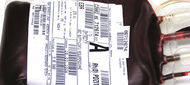 Člověk, který prodělal žloutenku, (ne)může darovat krev