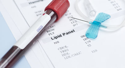 Zvládnutí neuropsychiatrických nežádoucích účinků antivirové léčby hepatitidy C umožňuje dosáhnout trvalé virologické odpovědi
