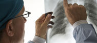 Intersticiální pneumonie spojená s interferonovou terapií u hepatitidy C
